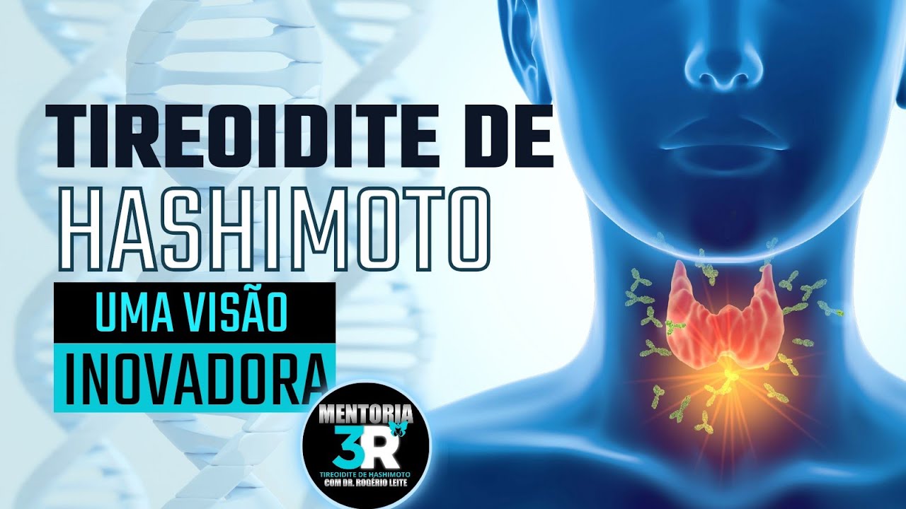 Tireoidite de Hashimoto: UMA VISÃO INOVADORA