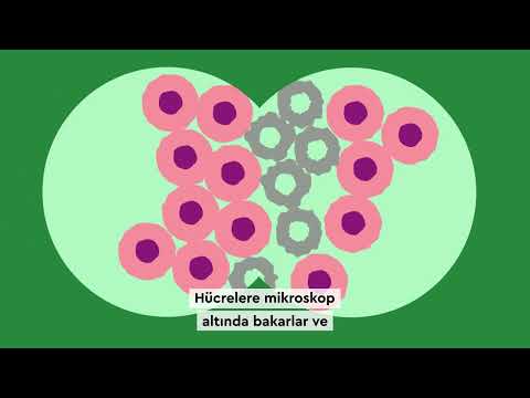What is cancer? (Turkish) | Kanser nedir? (Türkçe) | Macmillan Cancer Support