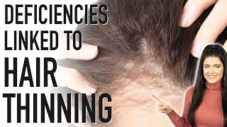 HAIR THINNING | 5 Nutrient Deficiencies Linked to Hair Loss (and how to fix it!)