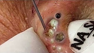 𝑅𝑒𝑐𝑙𝑎𝑖𝑚 𝑌𝑜𝑢𝑟 𝐺𝑙𝑜𝑤 𝐴𝑛𝑑 𝐶𝑎𝑙𝑚 𝑇ℎ𝑟𝑜𝑢𝑔ℎ 𝑀𝑖𝑛𝑑𝑓𝑢𝑙 𝑆𝑘𝑖𝑛𝑐𝑎𝑟𝑒 𝑀𝑜𝑚𝑒𝑛𝑡𝑠 #656878