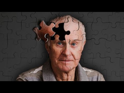 Testi 5 minutësh që zbulon sëmundjen e Alzheimerit dhjetë vjet përpara se të shfaqen simptomat