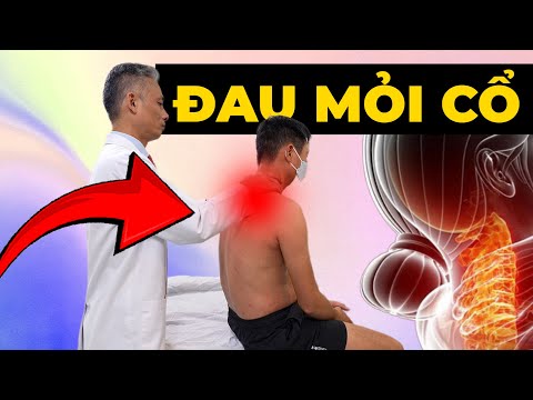 Đau Mỏi Cổ Kéo Dài Không Thể Sinh Hoạt? - Bác Sĩ Hướng Dẫn Phục Hồi