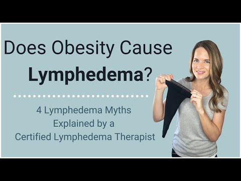 Does Obesity Cause Lymphedema? 4 Lymphedema Myths explained by a Certified Lymphedema Therapist