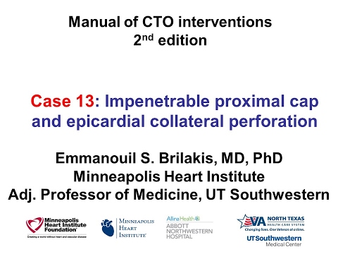 Case 13: Manual of CTO Interventions - Epicardial collateral perforation