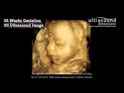 26 Weeks Pregnant - Your 26th Week Of Pregnancy