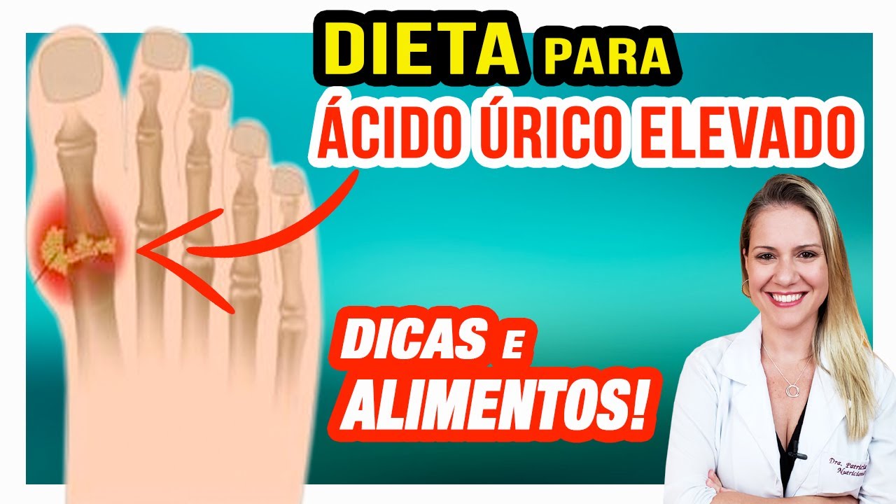 Dieta para Ácido Úrico Elevado / Gota [ALIMENTOS, CUIDADOS e DICAS]