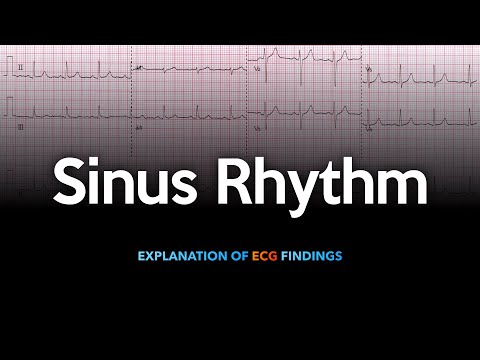 Normal 12-Lead ECG