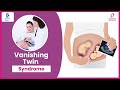VANISHING TWIN SYNDROME-Causes,Complication-Dr. Samatha Kumar of Cloudnine Hospitals|Doctors' Circle