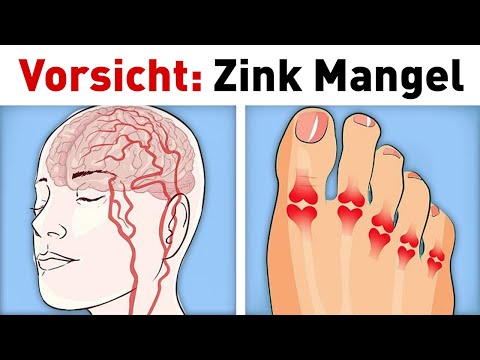 5 häufige Anzeichen für akuten Zink Mangel...