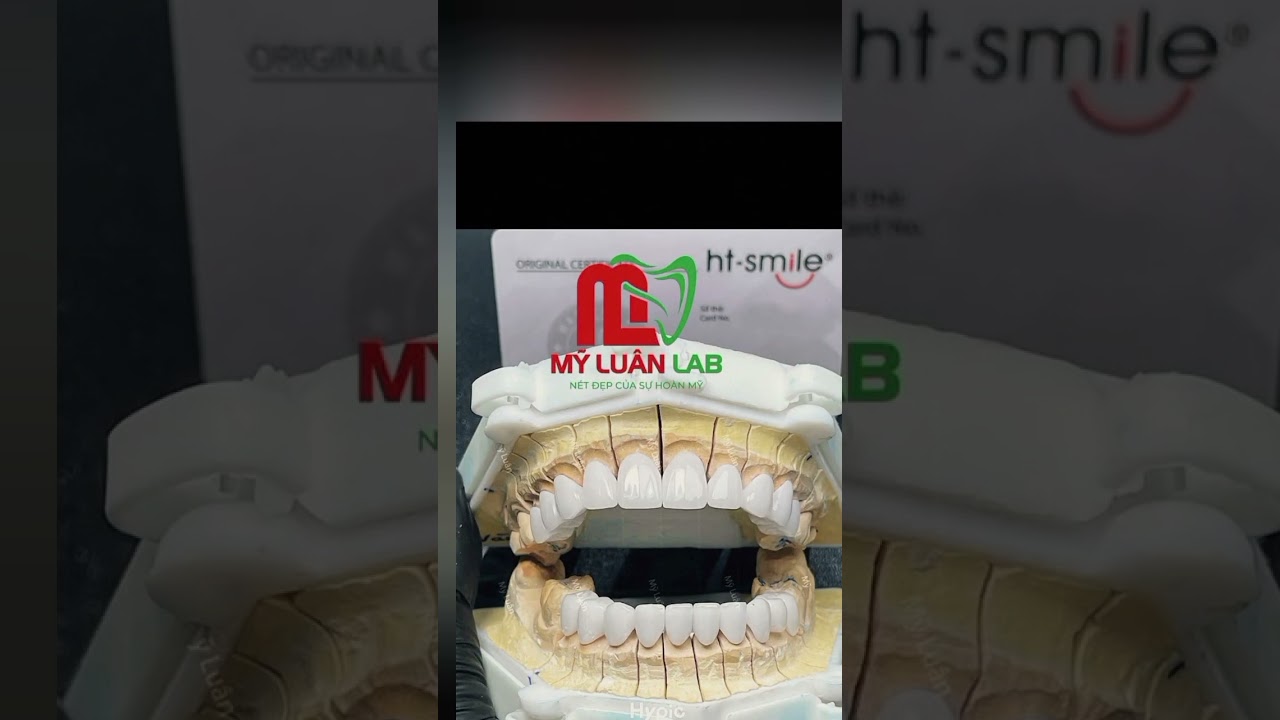 Thành Phẩm Răng Sứ HT Smile Đẹp Tự Nhiên Dành Cho Nha Khoa