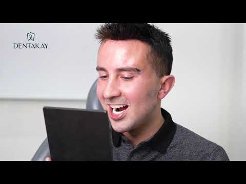 Rafael traveled from Ireland to get a Hollywood Smile in Turkey after an ACCIDENT!