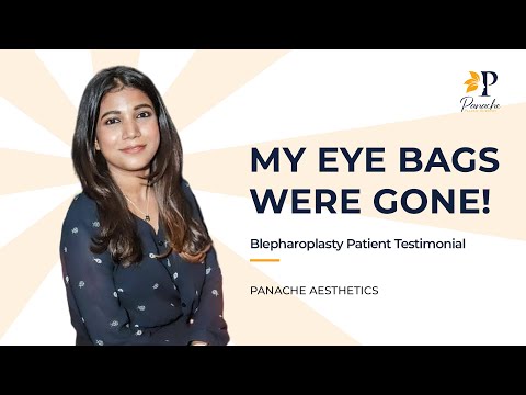 Face Surgery Patient Review
