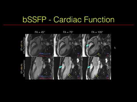ISMRM MR Academy - Evaluation of Cardiac Function: Technical Foundations