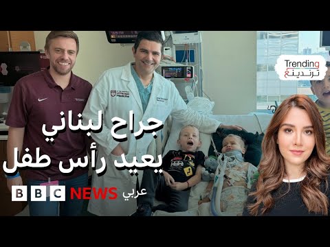 فيديو | في "سابقة طبية" .. الطبيب اللبناني محمد بيضون يعيد وصل رأس طفل بجسده