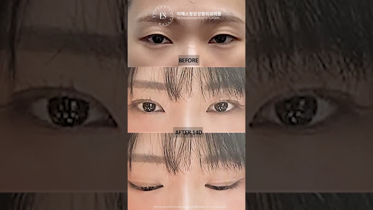 이에스 유튜브