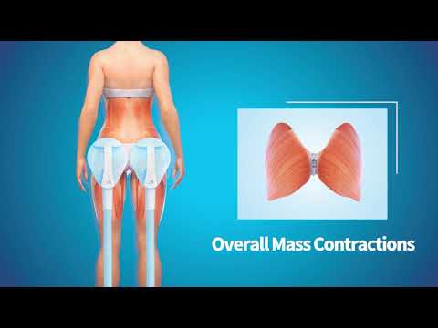 CMSlim™ How it Works