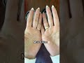 Sweaty hands gang 💧 Dermadry's iontophoresis solution for sweaty hands! - Dermadry Sweaty hands gang 💧 Dermadry's iontophoresis solution for sweaty hands!