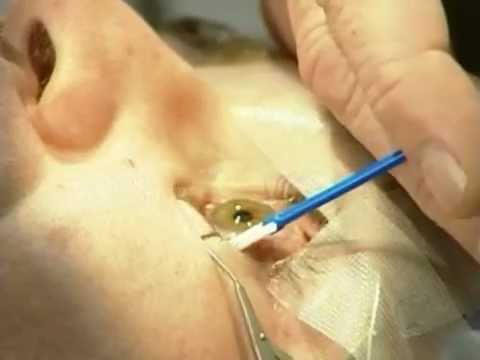 Prostatamassage Ust Kamenogorsk Nach der Behandlung von Prostatakrebs