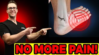Hairline Stress Fracture in the Foot? [Symptoms & Best TREATMENT]