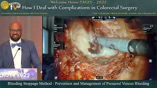 Bleeding Stoppage Method - Prevention and Management of Presacral Venous Bleeding