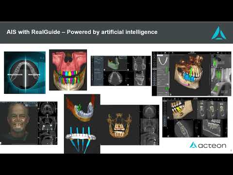 Acteon X-Mind Optima CBCT Introduction