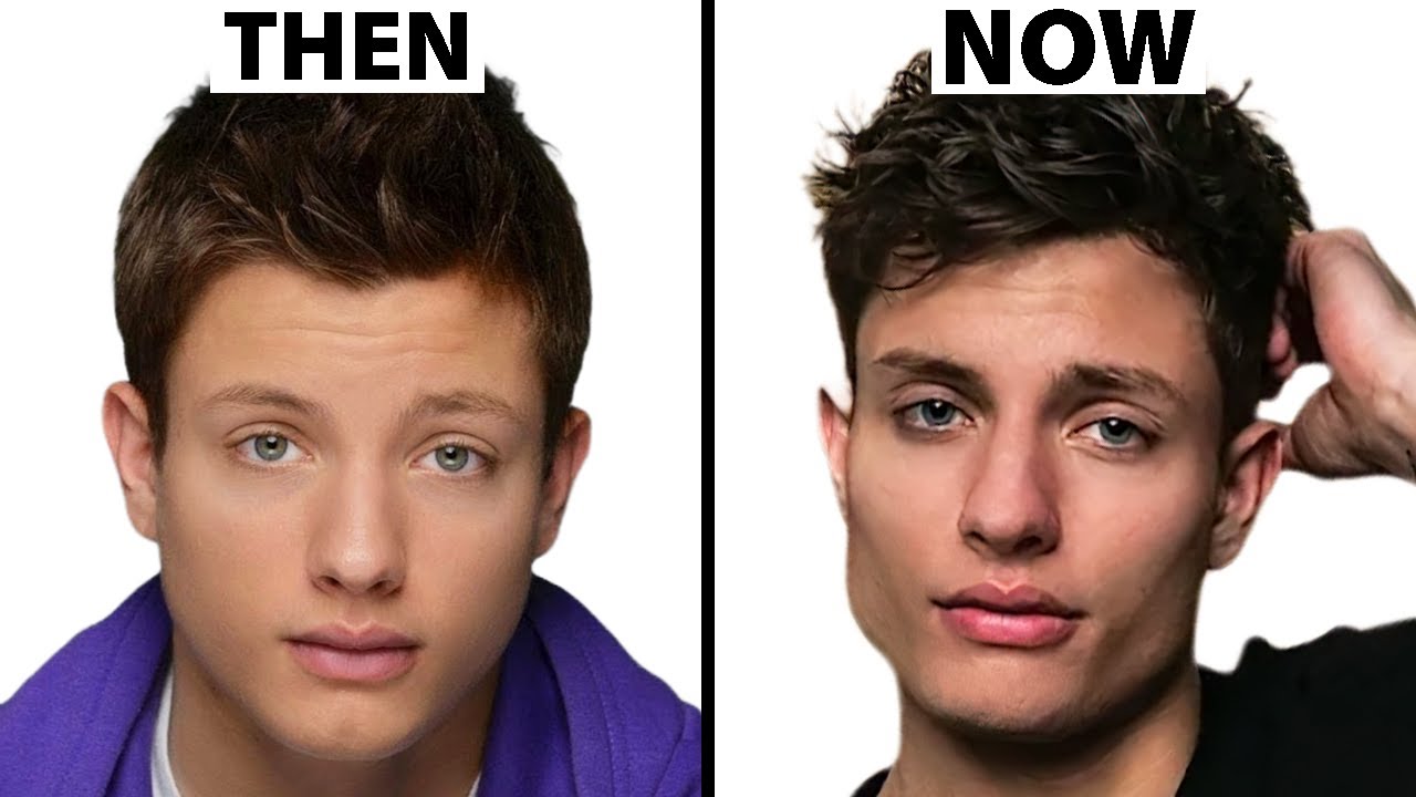 Matt Rife's SECRET Jaw Surgery? | Plastic Surgery Analysis