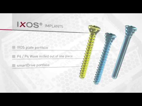 Ixos® Radius plate system by KLS Martin