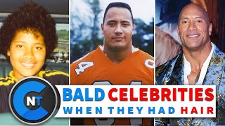 What Bald Celebrities Looked Like When They Had Hair | Bald Famous Personalities Then And Now | EP01