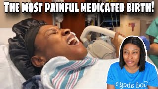 I had an unbelievably PAINFUL MEDICATED BIRTH! | EPIDURAL failed me! | My body was on FIRE!