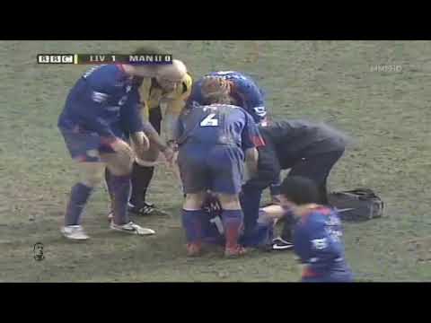Alan Smith vs John Arne Riise's free kick - The terrible injury ruined his career