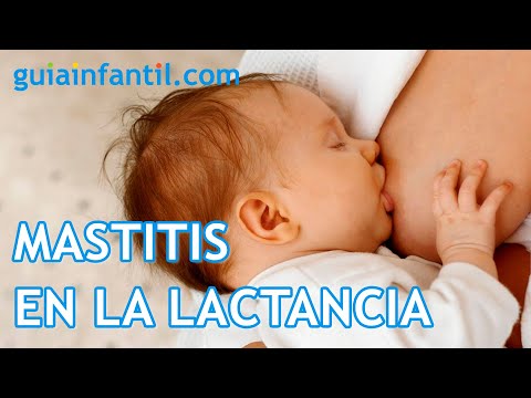 Mastitis durante la lactancia materna y síntomas Mastitis durante la lactancia materna y síntomas