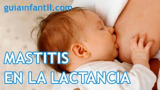 La mastitis durante la lactancia. Síntomas y tratamiento