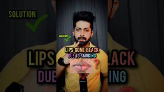 Solution For Black Lips Due To Smoking 🚬👄 #shorts #youtubeshorts #blacklips #lipscrub #skincare