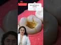 Root Canal Treatment RCT Dr Shweta Sharma Teethdecay Doctor