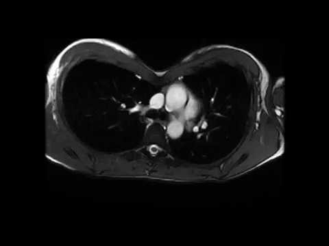 Cardiac MRI explained