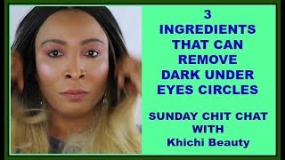 3 INGREDIENTS THAT CAN REMOVE DARK UNDER EYES CIRCLES |SUNDAY CHIT CHAT WITH  Khichi Beauty