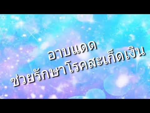 โรคสะเก็ดเงินเป็นกลัวเพียงหนึ่งผลิตภัณฑ์ การรักษา Viburnum ของโรคสะเก็ดเงิน
