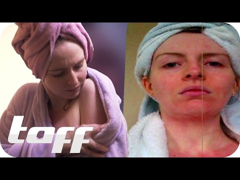 Allergisch gegen Wasser | taff