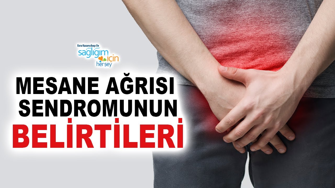 Mesane Ağrısı Sendromu Belirtileri