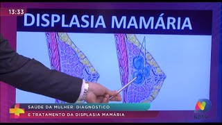 Displasia mamária / alterações fibrocísticas benignas da mama - Dr. Belarmino