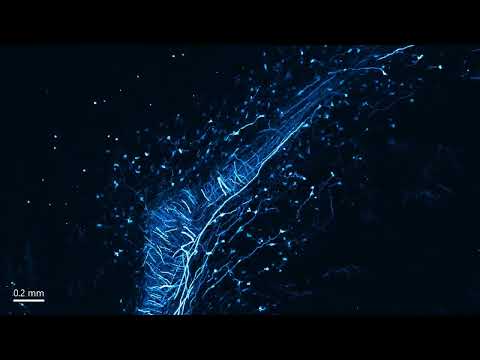 2022 09 11 125L xy cerebellum