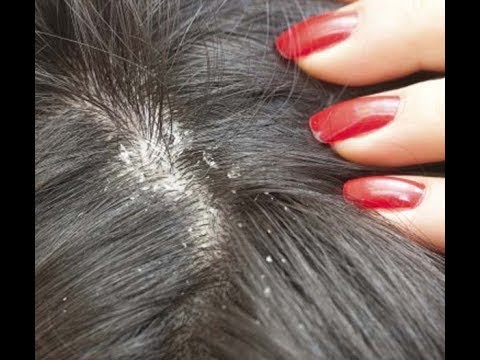 kezelés féregárammal típusú férgek széles skálájú hatásúak