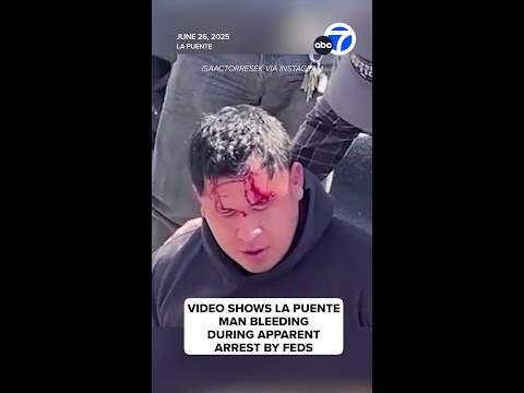 Video shows La Puente man bleeding during apparent arrest by feds