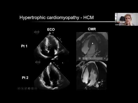 APPLICAZIONE DELLA RM CARDIOLOGIA DELLO SPORT