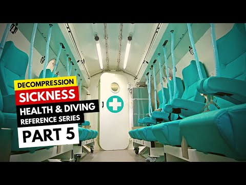 Treating Decompression Sickness