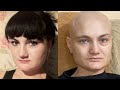 O Tânără De 32 De Ani Mamă A Doi Copii Suferă De Cancer De La 65 De Kg A Ajuns La 45