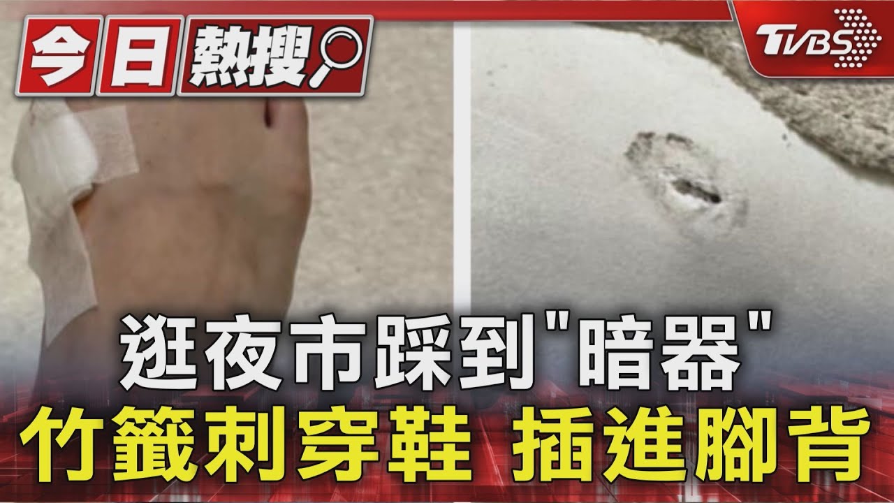 夜市驚魂!「隨意丟棄竹籠」成致命陷阱 民眾走路突劇痛 腳背血流如注