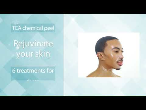 FairSkin Spa Tca chemical peel special