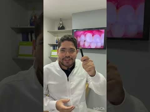 video r3nNBCrmlYM