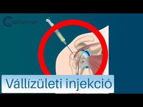 milyen vitaminok az ízületi betegségek esetén